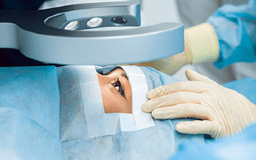 Oculoplasty